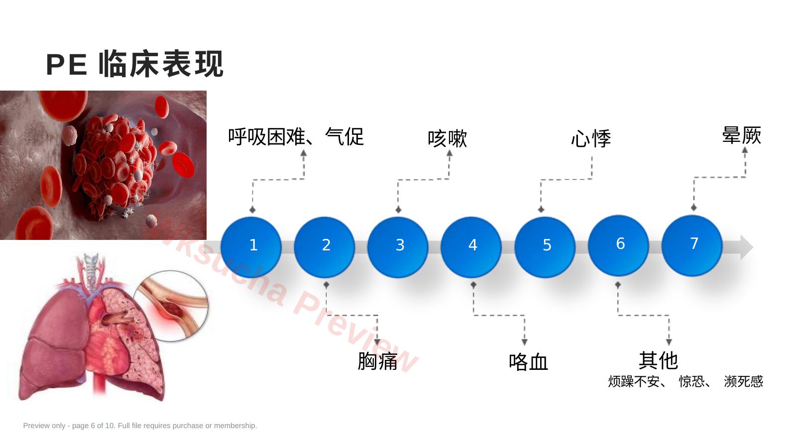 预览第 6 页