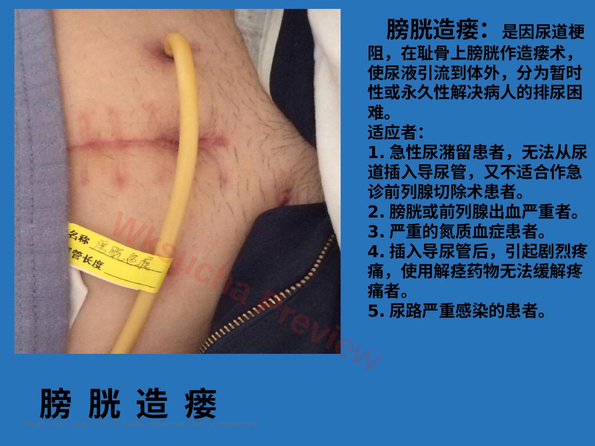 预览第 11 页
