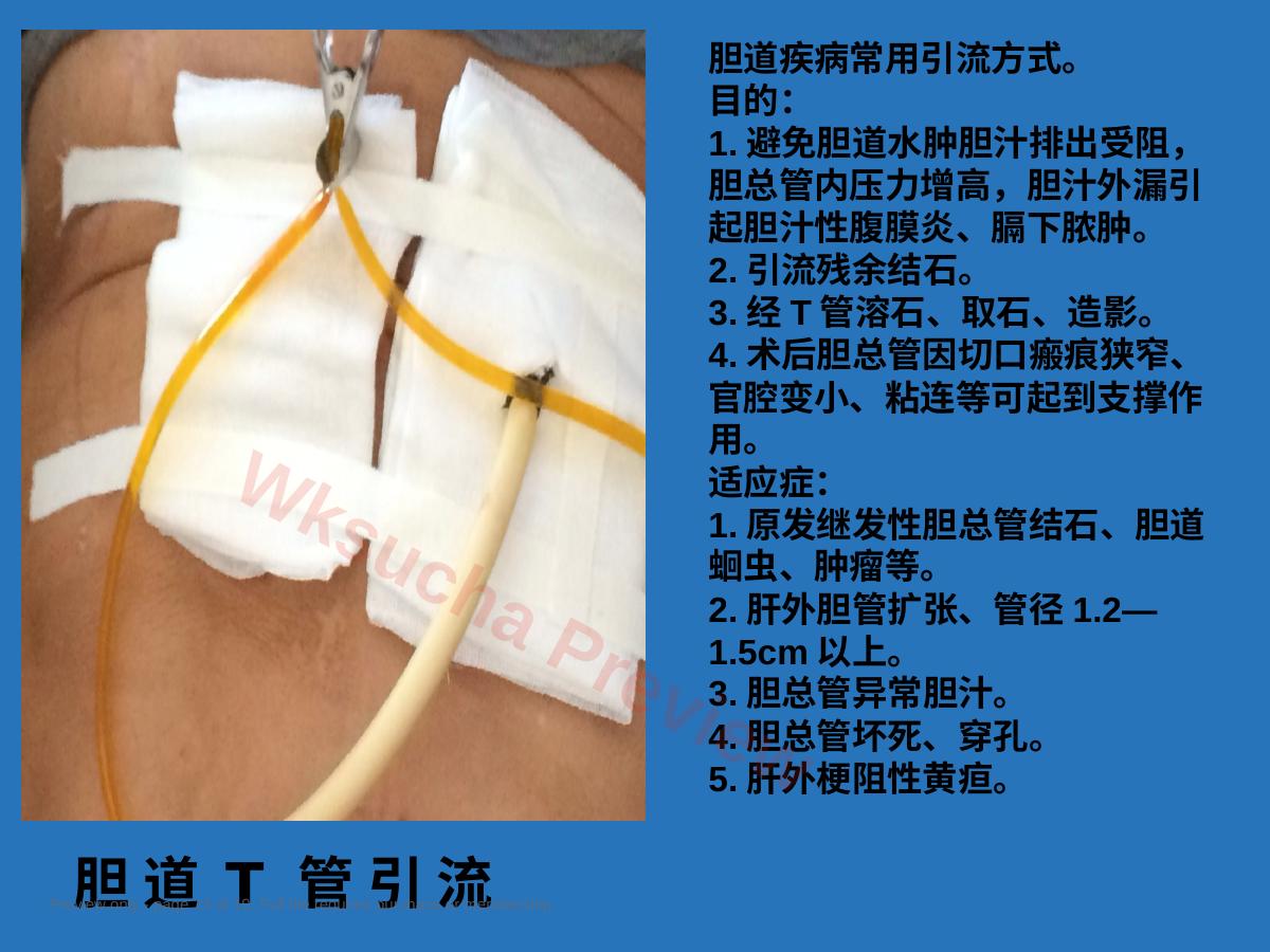 预览第 14 页
