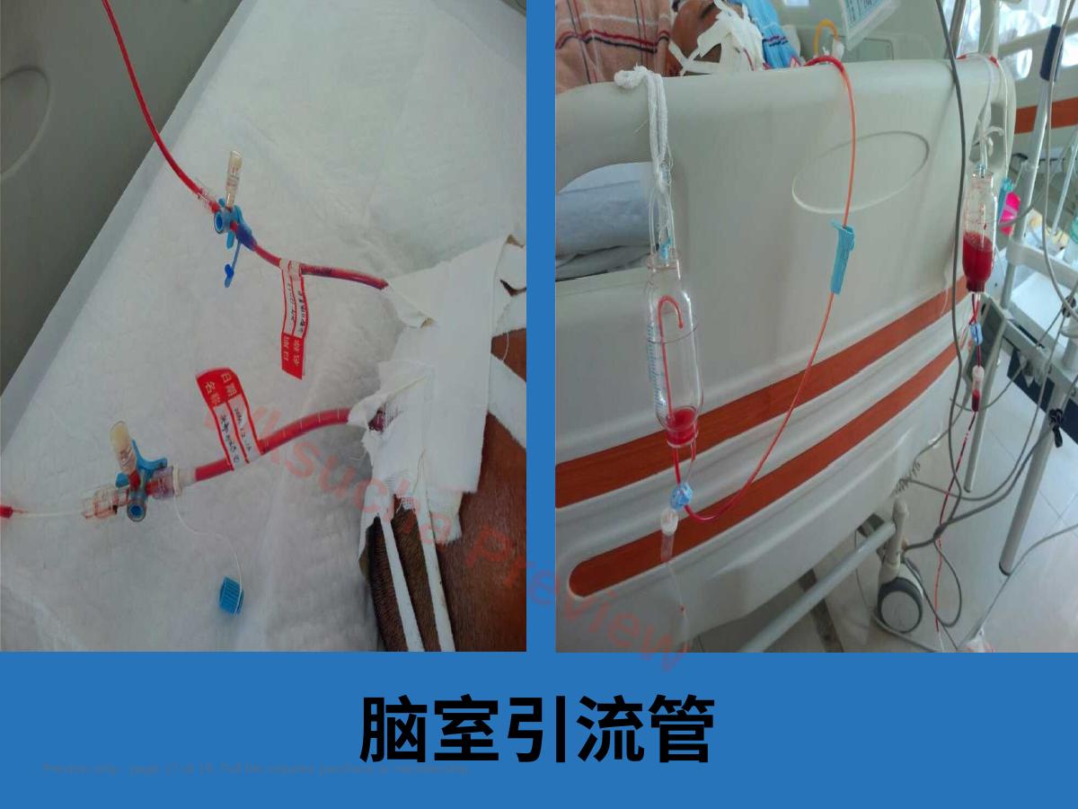 预览第 17 页